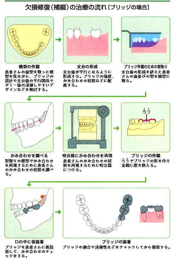 mienai