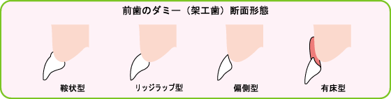 mienai
